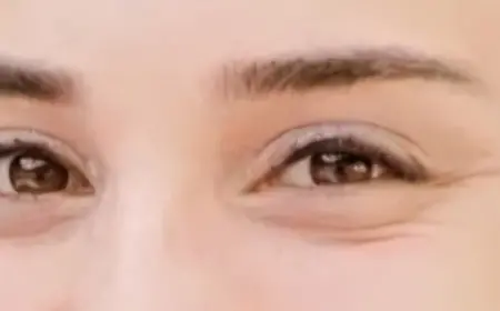 GÖZLERİN OLMASAYDI